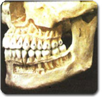 http://www.drkhalilollah.com/orofacia