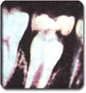http://www.drkhalilollah.com/orofacial
