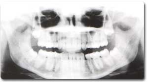 http://www.drkhalilollah.com/orofacial