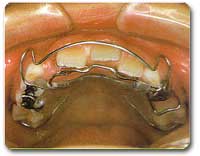 http://www.drkhalilollah.com/ortho