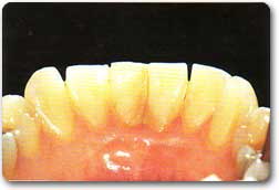 http://www.drkhalilollah.com/perio