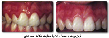 http://www.drkhalilollah.com/perio