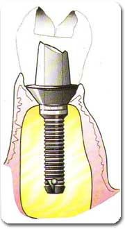 http://www.drkhalilollah.com/porosto