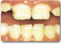 http://www.drkhalilollah.com/repair